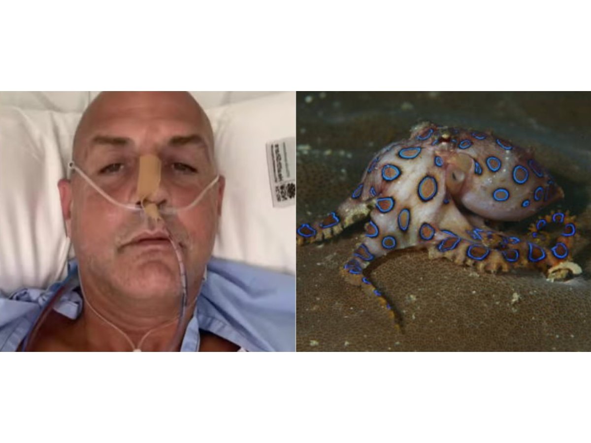 Turista en Australia sufre parálisis tras picadura del pulpo más venenoso del mundo