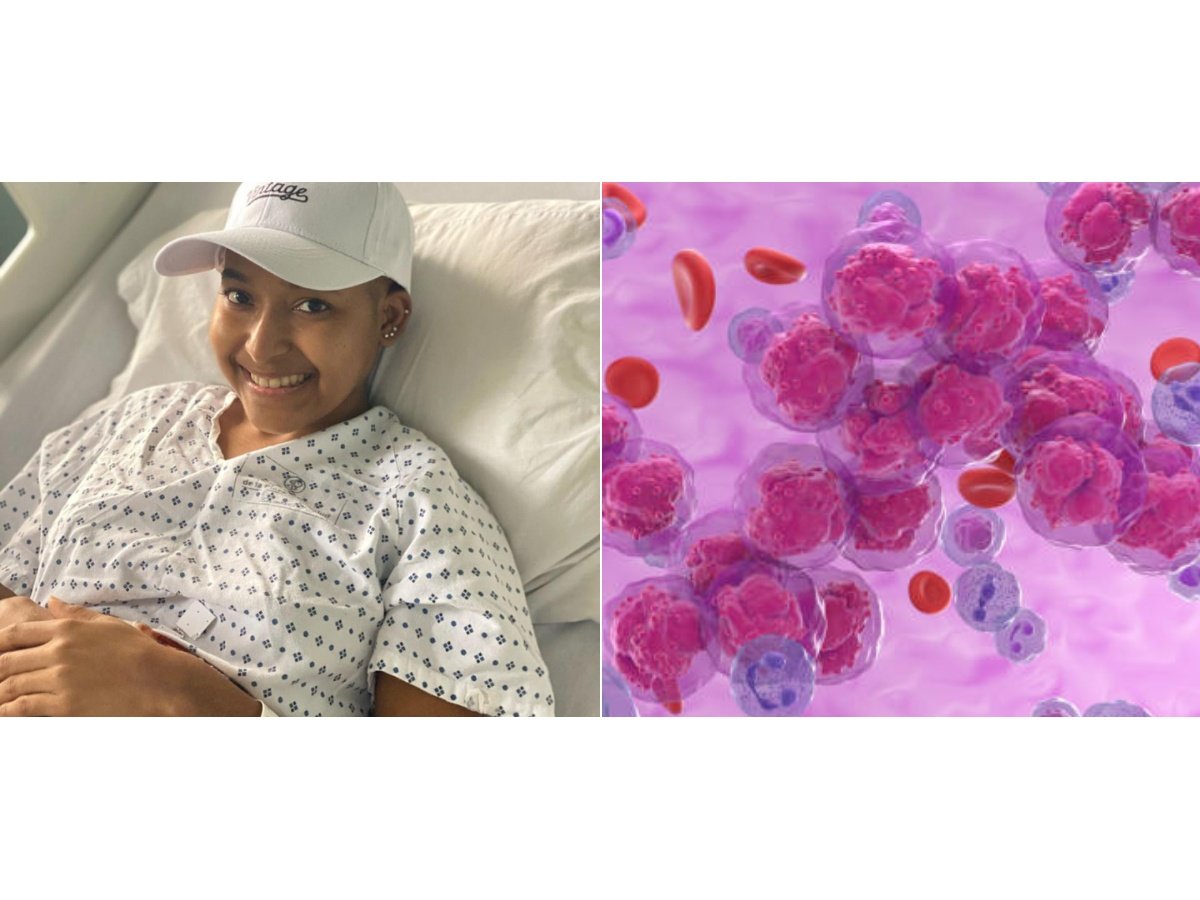 Joven salvadoreña enfrenta leucemia y espera medicamento vital para trasplante de médula ósea