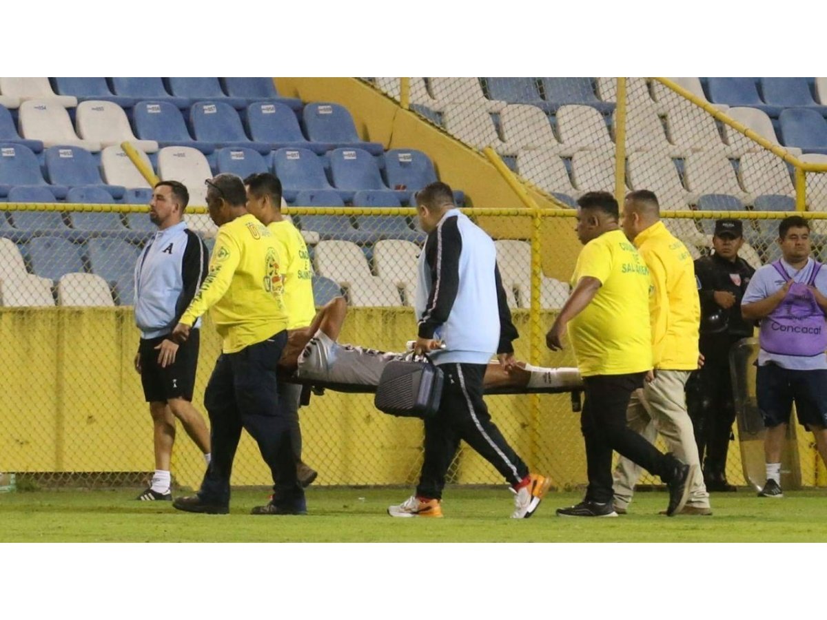 Harold Osorio sufre lesión y abandona en camilla el partido Alianza vs Inter FA