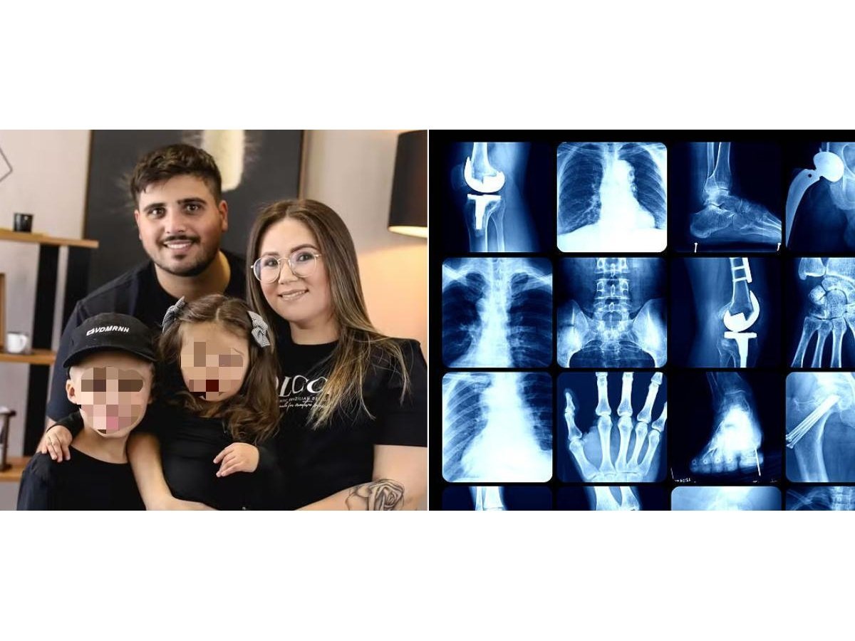 Madre comparte experiencia de osteogénesis imperfecta heredada por sus hijos y adapta su hogar para su cuidado