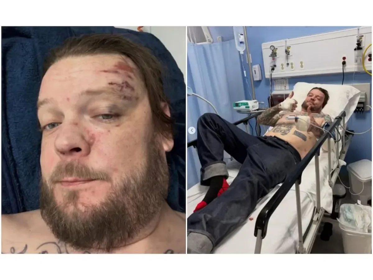 Corey Harrison enfrenta bancarrota tras grave accidente en México y solicita apoyo económico