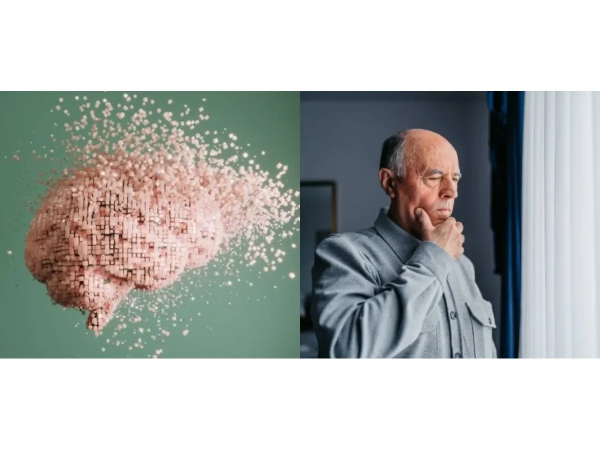 Impacto de los carbohidratos en el riesgo de Alzheimer: un análisis detallado