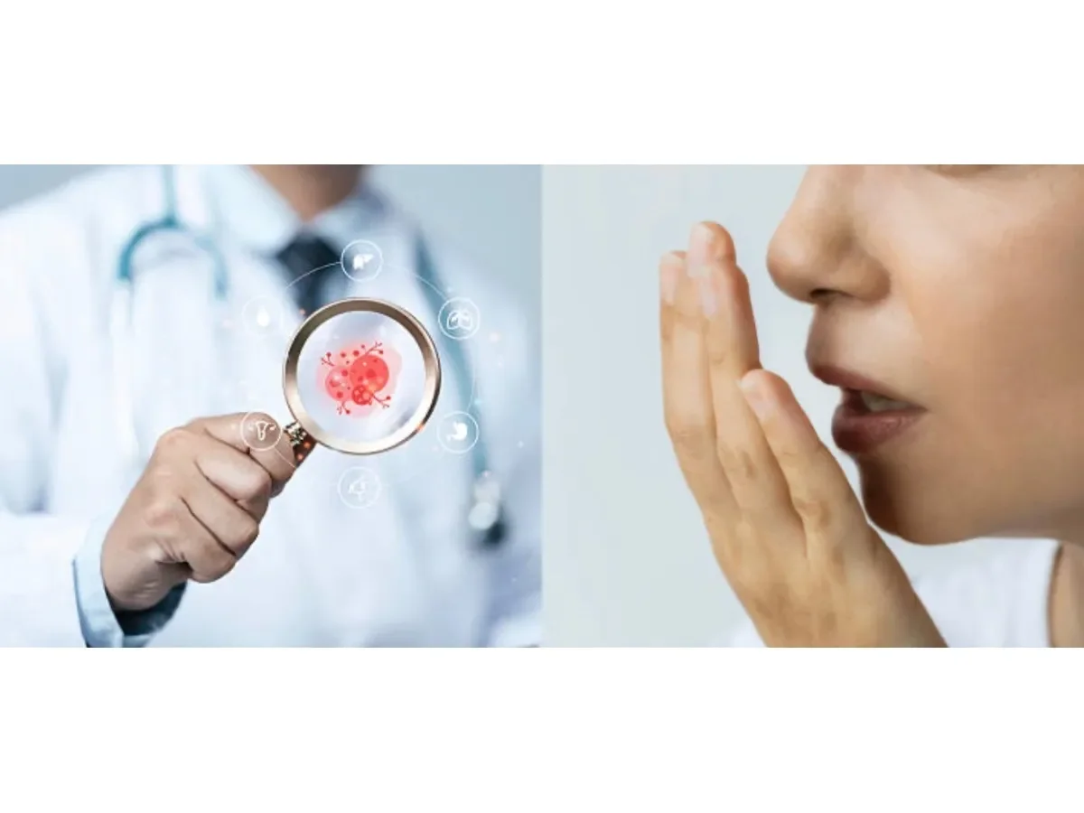 Mal aliento persistente: una posible señal temprana de cáncer que no debe ignorarse