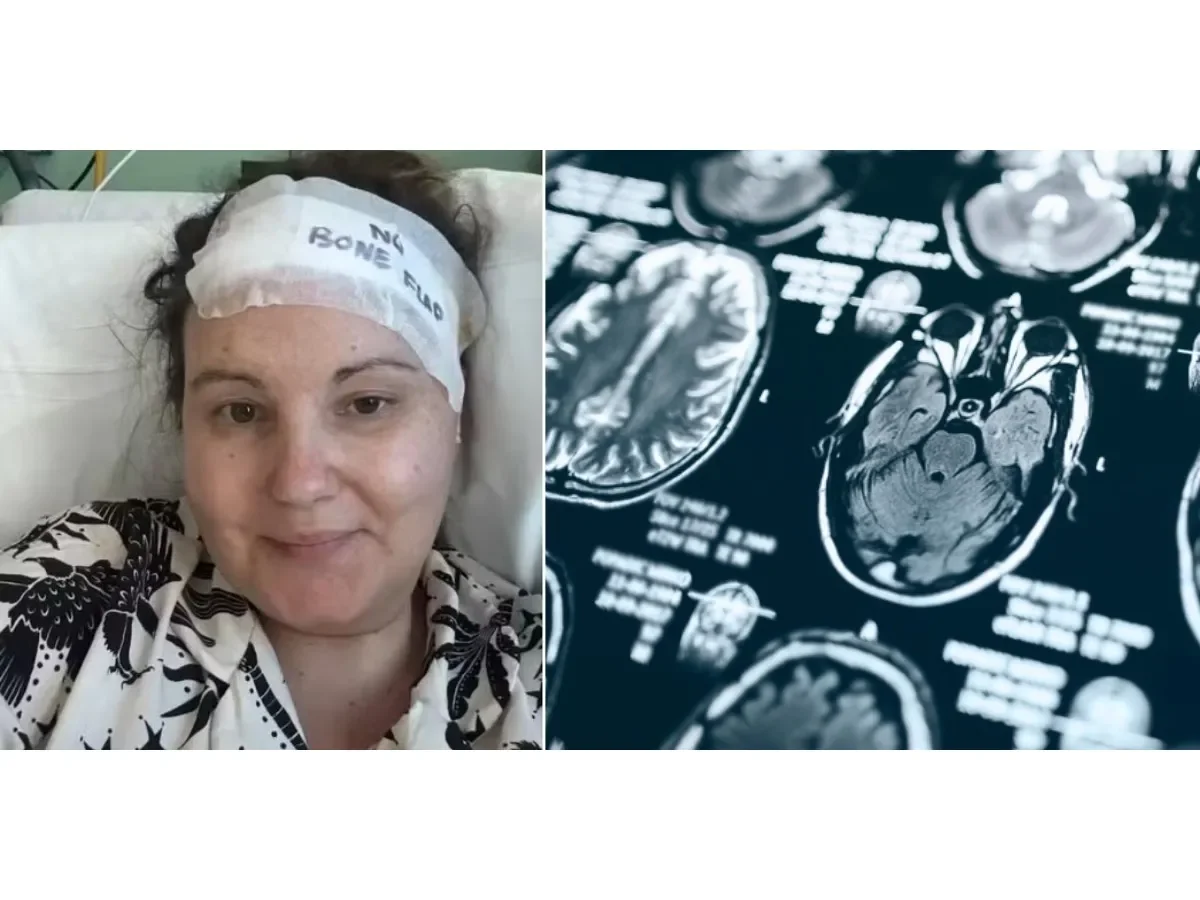 Tras 20 años con dolores de cabeza, descubren tumor cerebral del tamaño de una mandarina Tras 20 años con dolores de cabeza, descubren tumor cerebral del tamaño de una mandarina