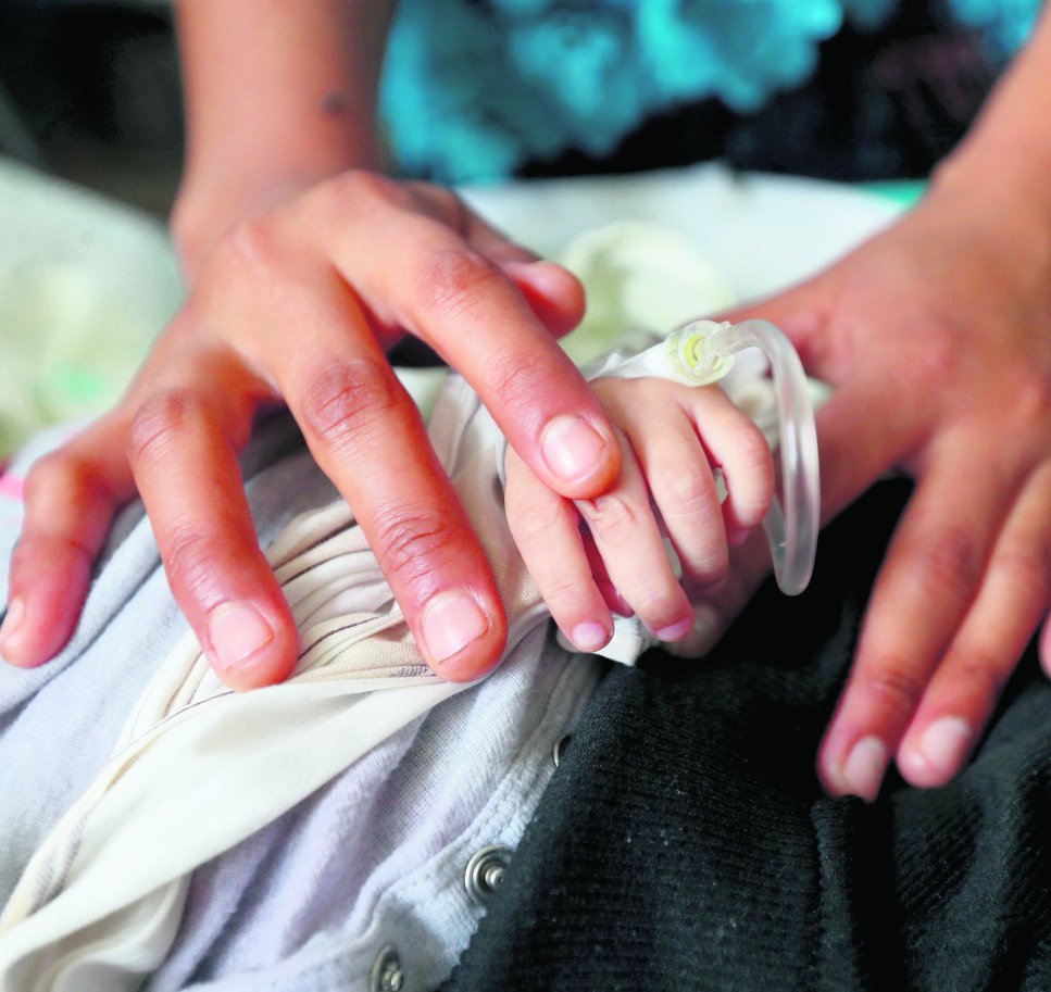 Alta Verapaz registra dos muertes infantiles por desnutrición aguda en 2026