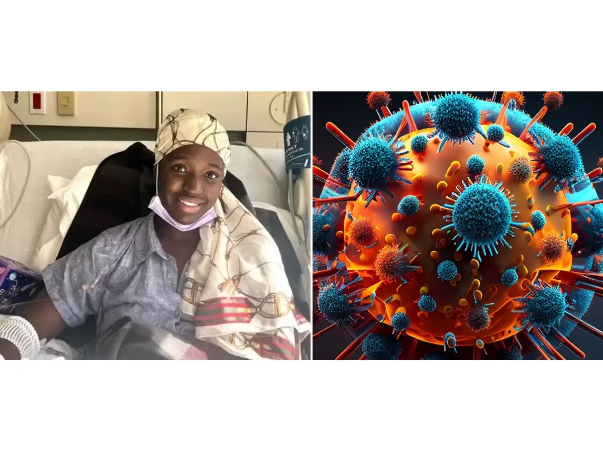 Fallece a los 22 años exreina de belleza por carcinoma de células en anillo de sello, cáncer ultra raro y agresivo