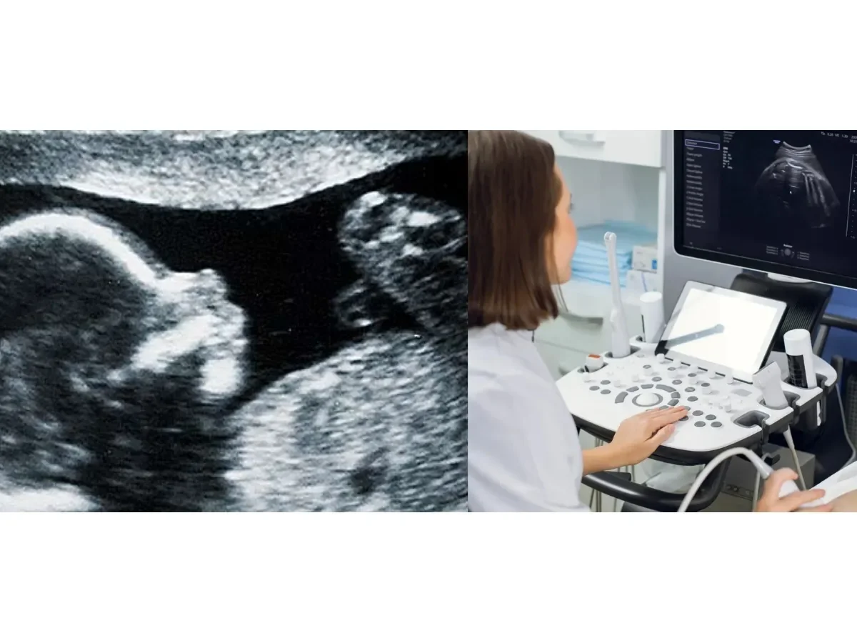 Condenan a médica en Italia por no detectar malformación fetal y deberá pagar 147,000 euros