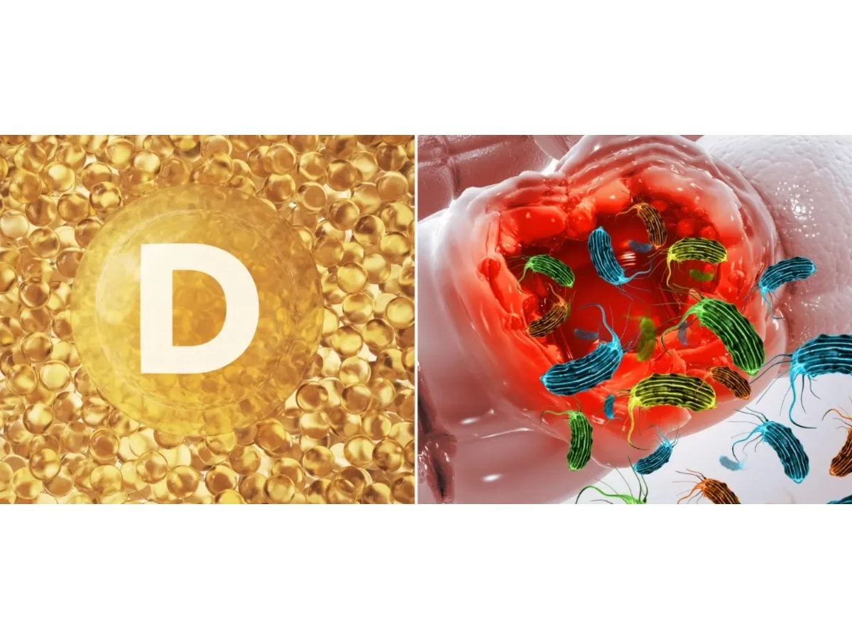 Estudio revela vínculo entre vitamina D y microbioma intestinal en enfermedad inflamatoria