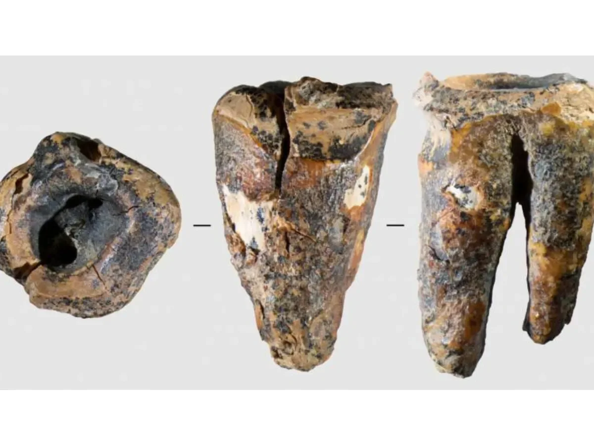 Hallazgo revela que neandertales trataban caries dentales con herramientas de piedra hace 59,000 años Hallazgo revela que neandertales trataban caries dentales con herramientas de piedra hace 59,000 años