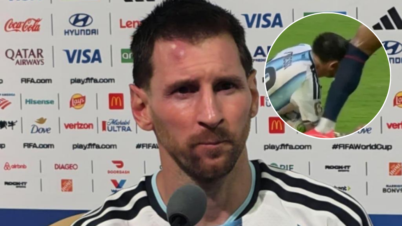 “El chinchón” de Messi: así fue la jugada que causó el golpe al capitán de Argentina “El chinchón” de Messi: así fue la jugada que causó el golpe al capitán de Argentina